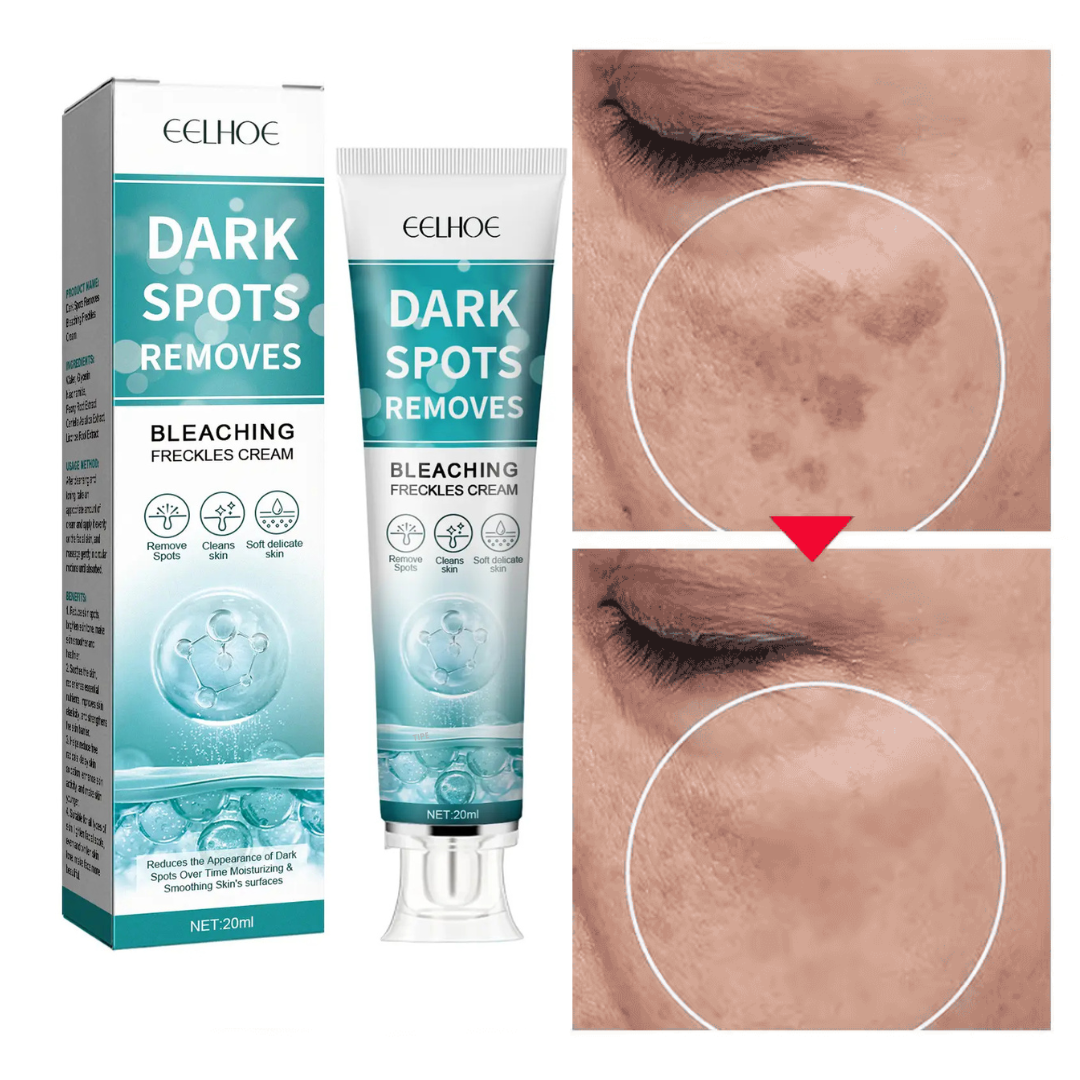 Crema Profesională de Albire și Împotriva Petelor pielii