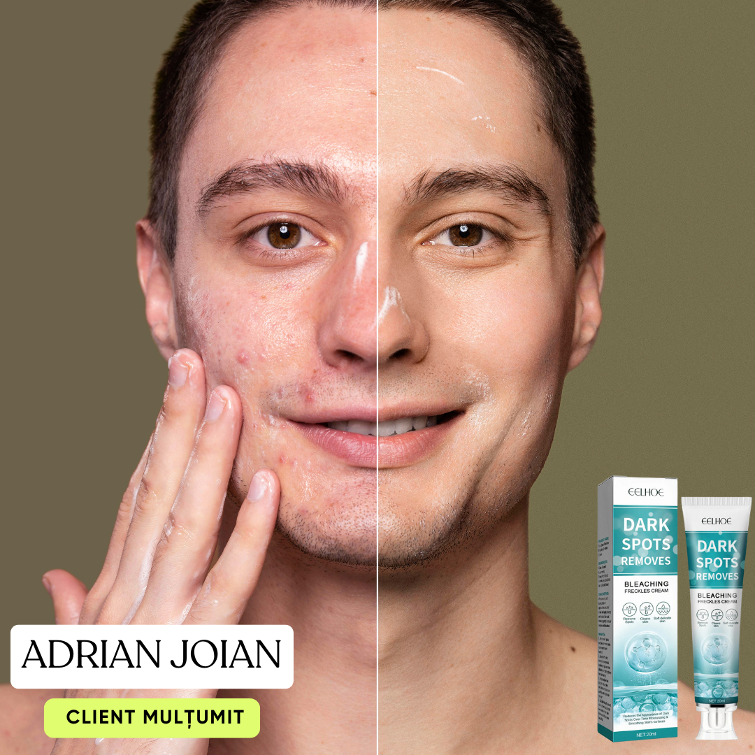 Crema Profesională de Albire și Împotriva Petelor pielii