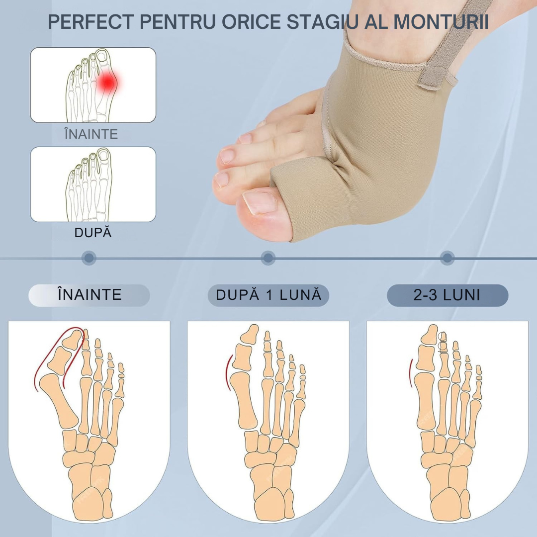 Corector de Monturi Cu Fir TEXELET Inteligent Profesional