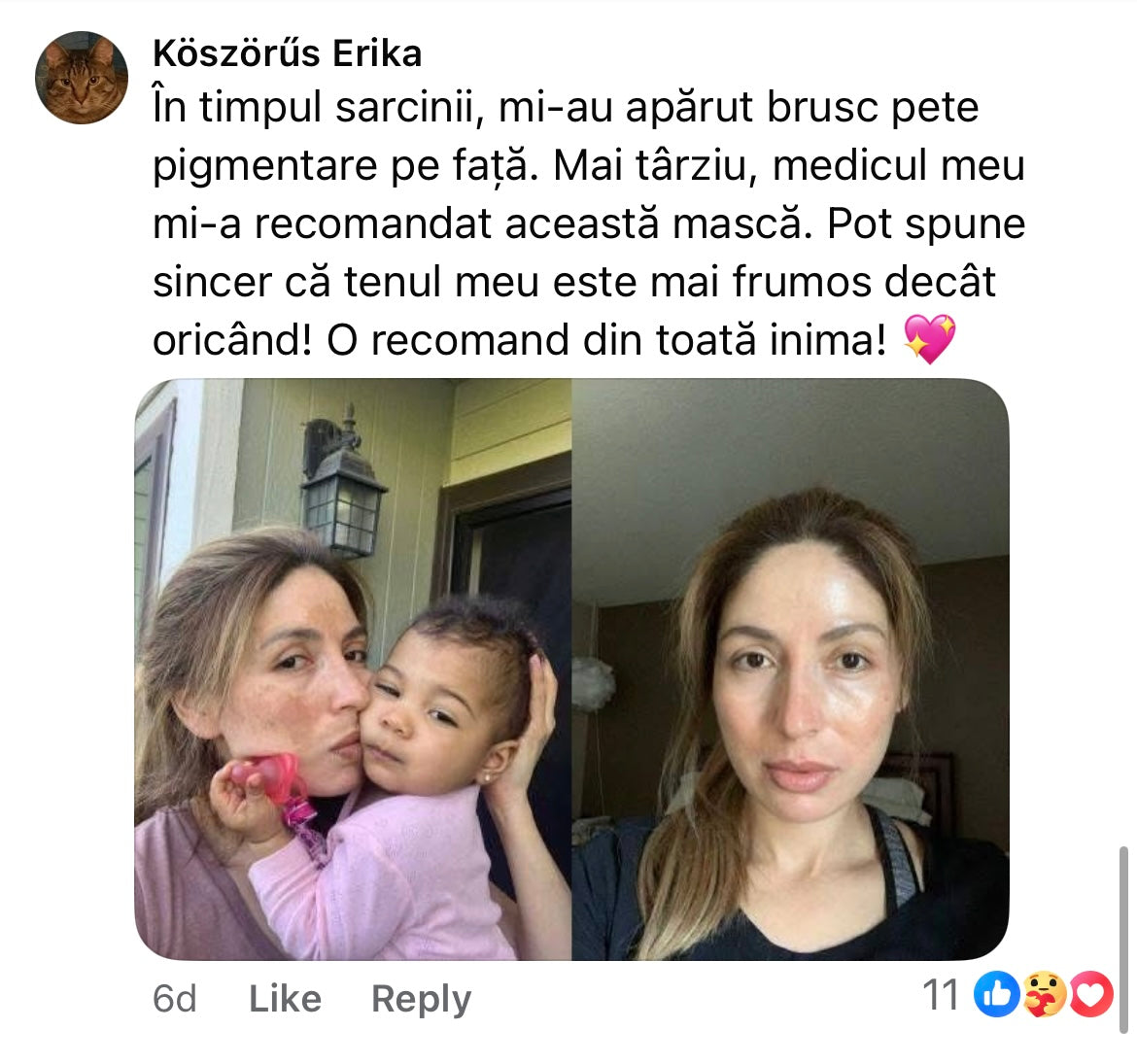 Cremă Profesională  Împotriva Petelor Pielii