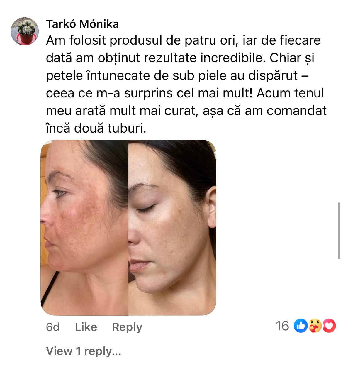 Cremă Profesională  Împotriva Petelor Pielii
