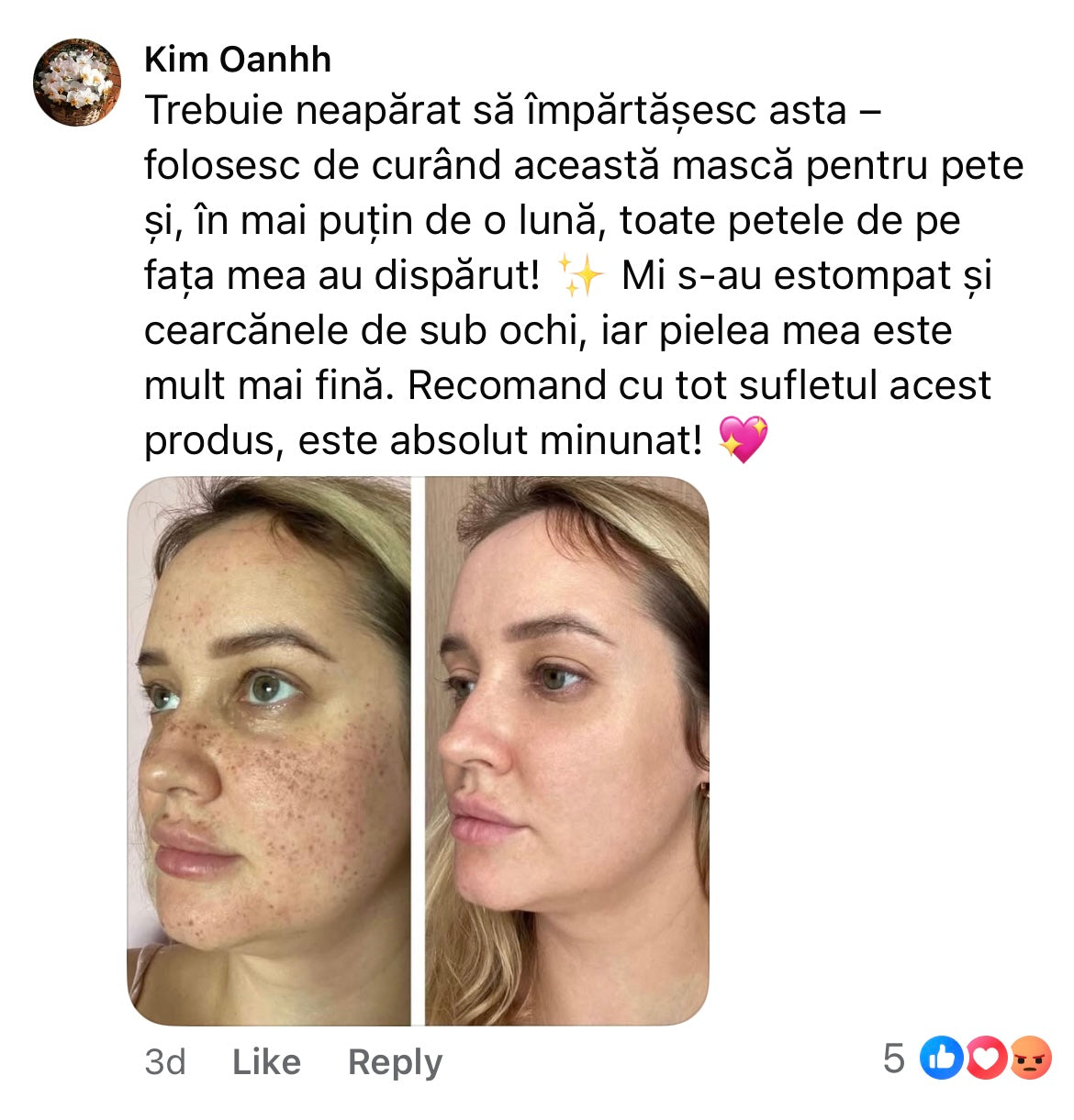Cremă Profesională  Împotriva Petelor Pielii
