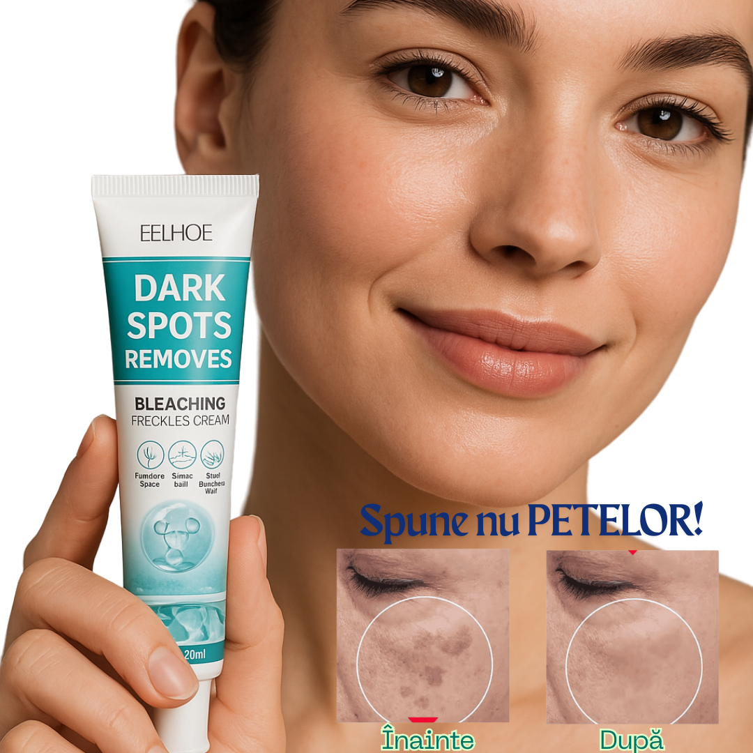 Crema Profesională de Albire și Împotriva Petelor pielii